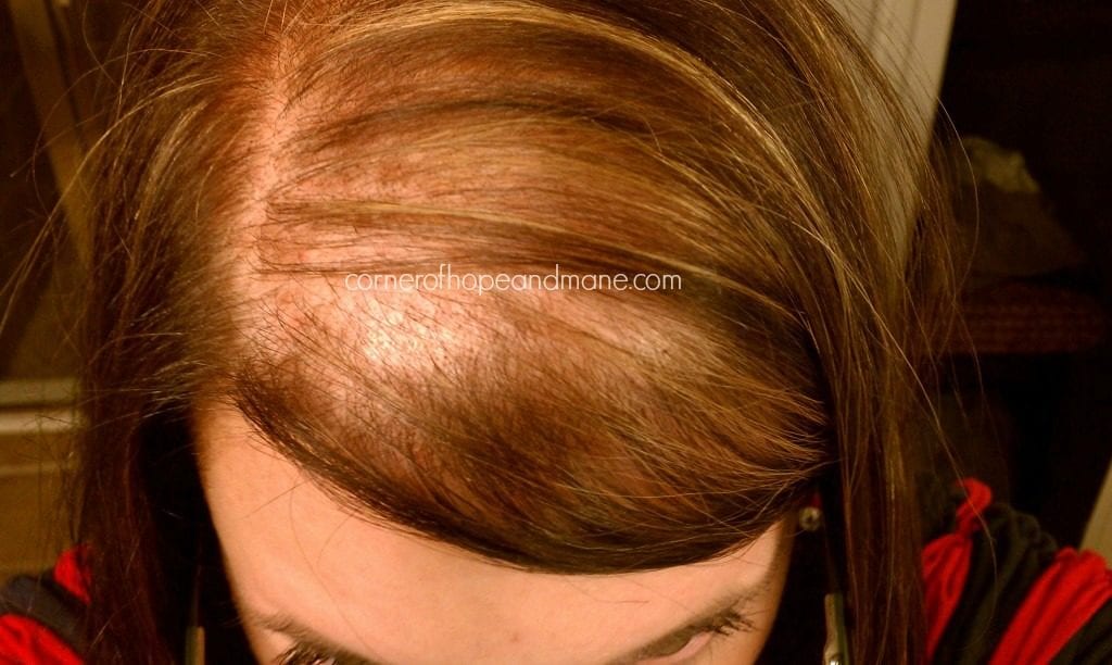 Can wearing a ginger wig camouflage a receding hairline?