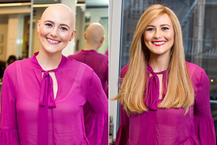 Can wearing a ginger wig help during chemotherapy?