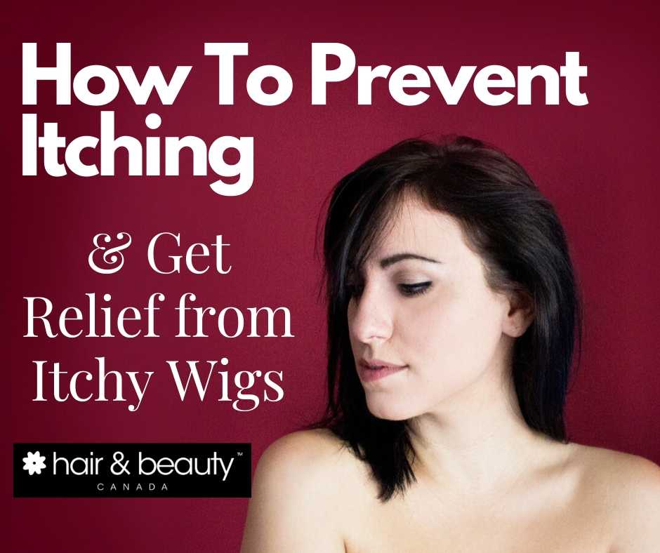 Does wearing ginger wigs cause itchiness?