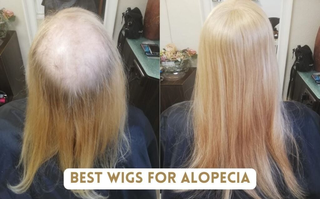 Are ginger wigs suitable for people with alopecia?